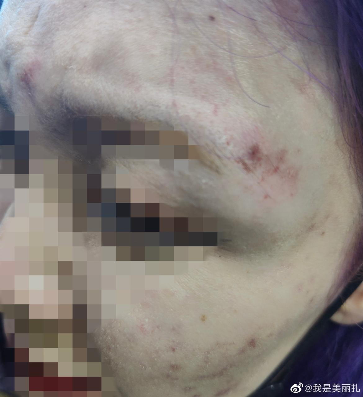 曝成源酒吧殴打女生，报警后仍然叫嚣：知道我是谁吗？我是鲁能的