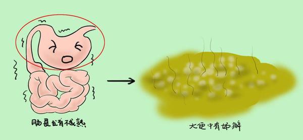 超全超详细宝宝各种大便解析(认识这11种便便判断宝宝健康很轻松)